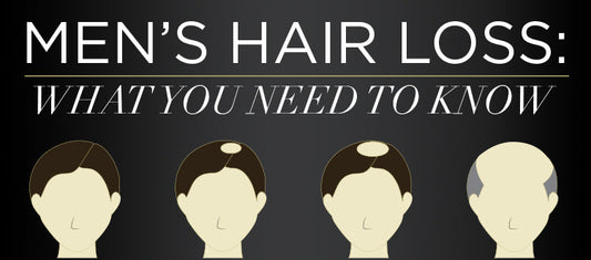 Men's hair loss: what you need to know