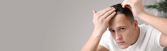 Man examining his hairline