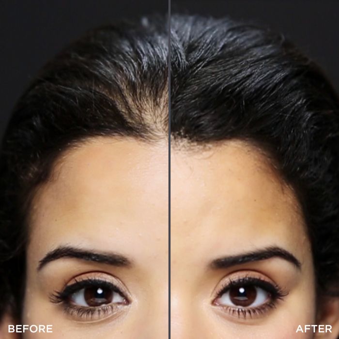 Before and After of a Woman Using Toppik Hair Building Fibers