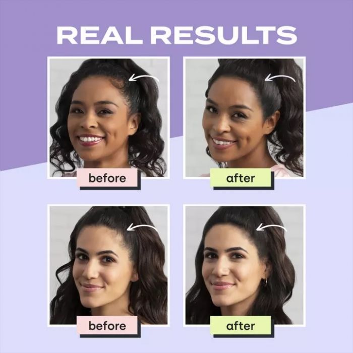 Toppik Real Results: Before and After Image of Woman's Usage