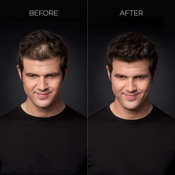 Before and After View of Man's Head Using Toppik Hair Building Fibers