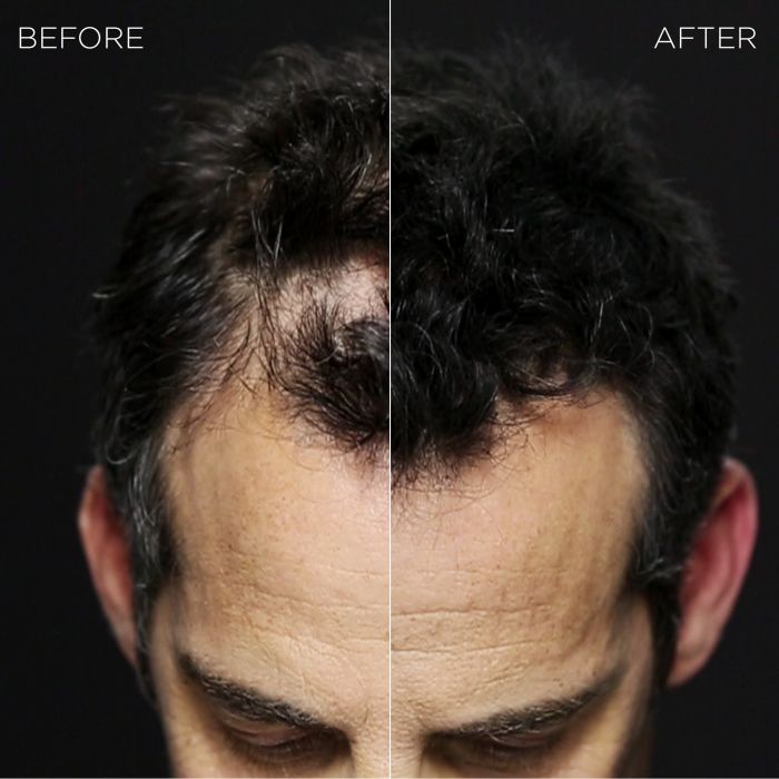 Before and After Top View of Man's Head Using Toppik Hair Building Fibers