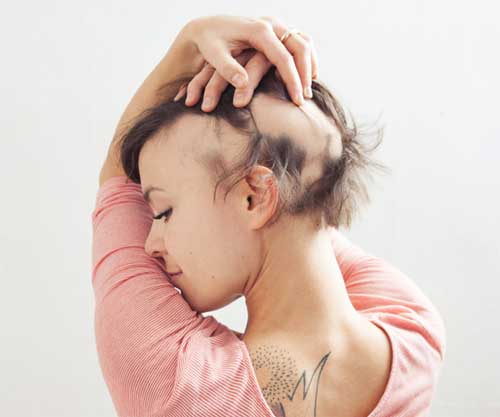 Hair Loss Causes & Treatments - Toppik Blog