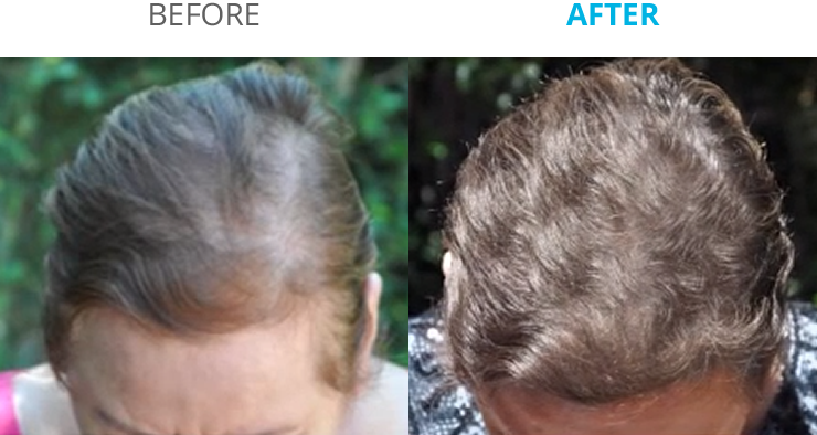 before_after_b@2x