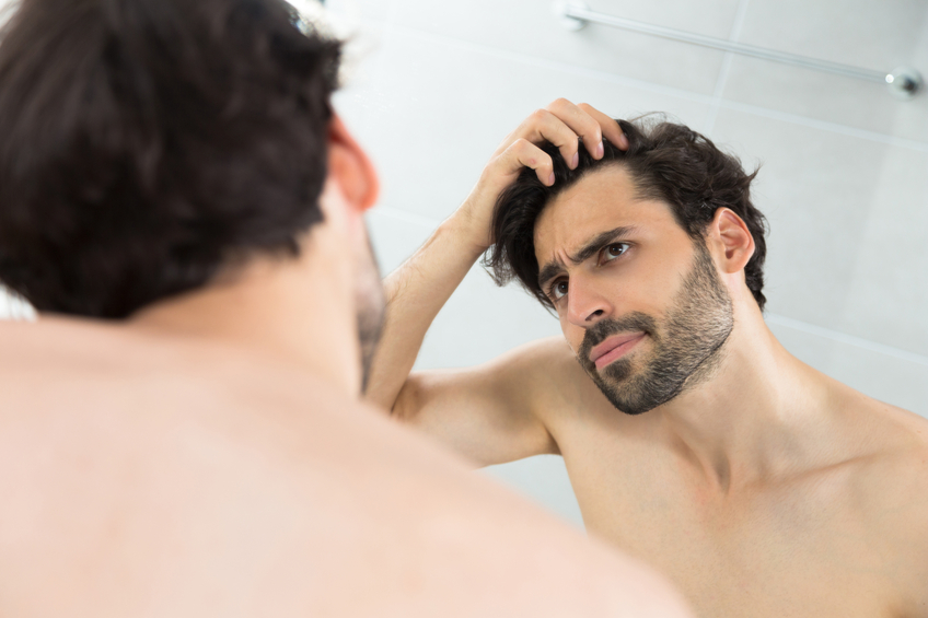 Caucasian adult man checking hairline.Hair loss problems