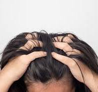 Hair Loss In Teens