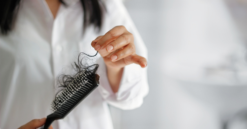 Woman with excess hair in the exogen (hair shedding) phase
