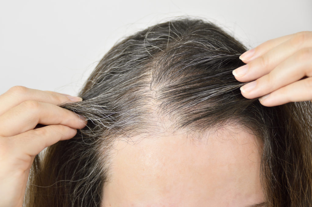 center part hair closeup examine gray hair scalp spotting telogen effluvium symptoms toppik hair blog